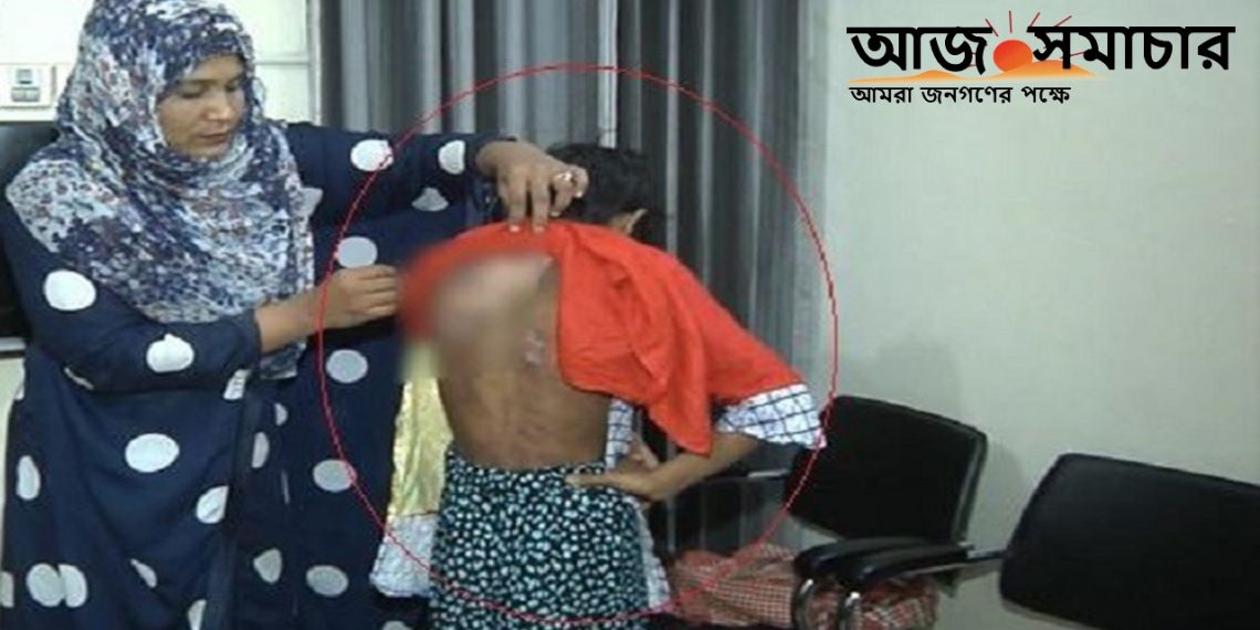 গরম খুন্তির ছ্যাঁকা দিয়ে গৃহকর্মীকে নির্যাতন-আটক গৃহকর্ত্রী