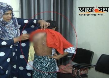 গরম খুন্তির ছ্যাঁকা দিয়ে গৃহকর্মীকে নির্যাতন-আটক গৃহকর্ত্রী