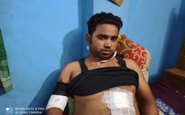 সোনারগাঁ থানার ১০০ গজ দুরুত্বে ডাকাতের ছুরিকাঘাতে দোকানী আহত ও নগদ ২ লক্ষ টাকা লুট