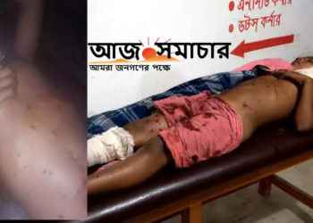 গজারিয়ায় বাড়ির ভিতর বোমা বিস্ফোরণে ৩জন কিশোর আহত