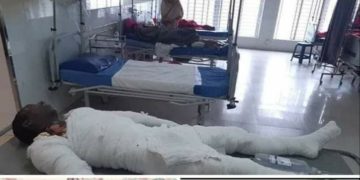 সোনারগাঁয়ে মোবাইল বিস্ফোরণে দগ্ধ ছেলের পর মায়ের মৃত্যু