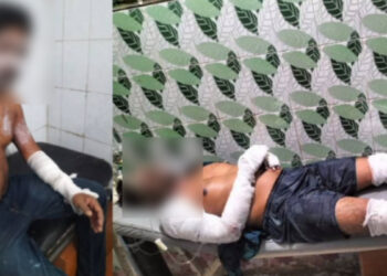কাঁচপুরে রান্নাঘরের গ্যাস লিকেজ থেকে   আগুন, দগ্ধ -৪