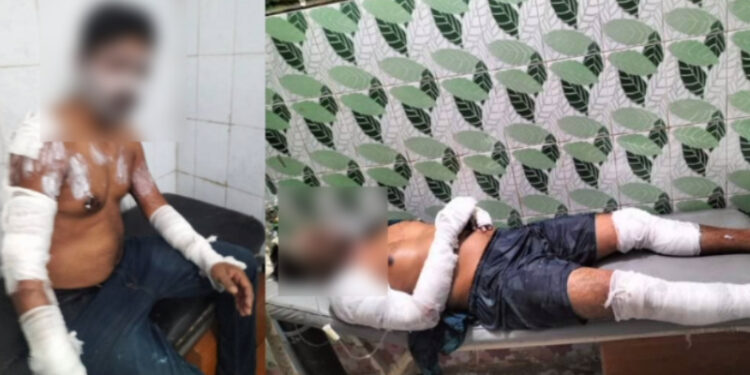 কাঁচপুরে রান্নাঘরের গ্যাস লিকেজ থেকে   আগুন, দগ্ধ -৪