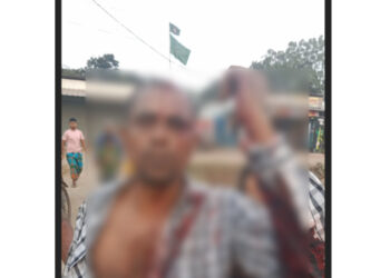 সোনারগাঁয়ে যুবলীগ নেতাকে কুপিয়ে ও পিটিয়ে হত্যা চেষ্টা