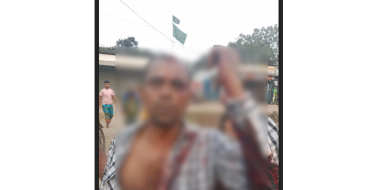 সোনারগাঁয়ে যুবলীগ নেতাকে কুপিয়ে ও পিটিয়ে হত্যা চেষ্টা