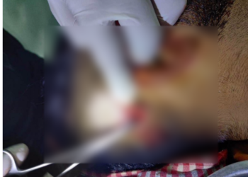 রূপগঞ্জে গুলিবর্ষণের ঘটনায়   দশ দিনেও মামলা  রুজু হয়নি, আতঙ্কে বাদীপক্ষ