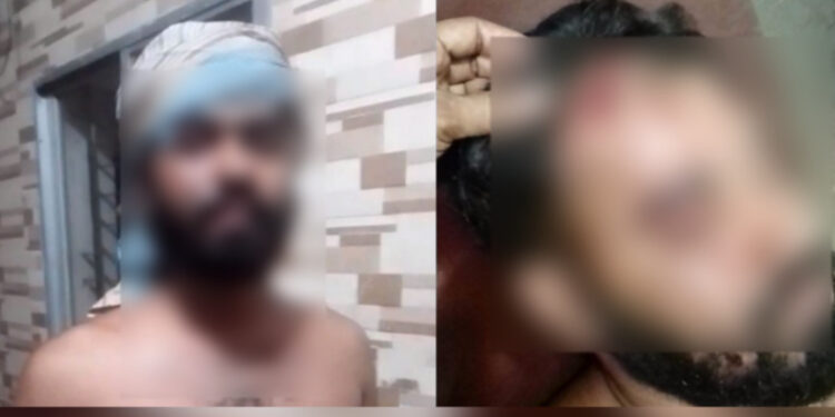 কাঁচপুরে দোকান বাকির ২শ টাকা না পেয়ে ৩ জনকে কুপিয়ে ও পিটিয়ে জখম