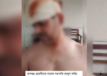 রূপগঞ্জে ছাত্রলীগ নেতাকে কুপিয়ে হত্যার চেষ্টা