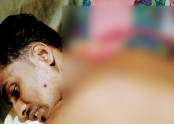 বগুড়ার বাকপ্রতিবন্ধীকে হত্যার চেষ্টায় ছুরিকাঘাত