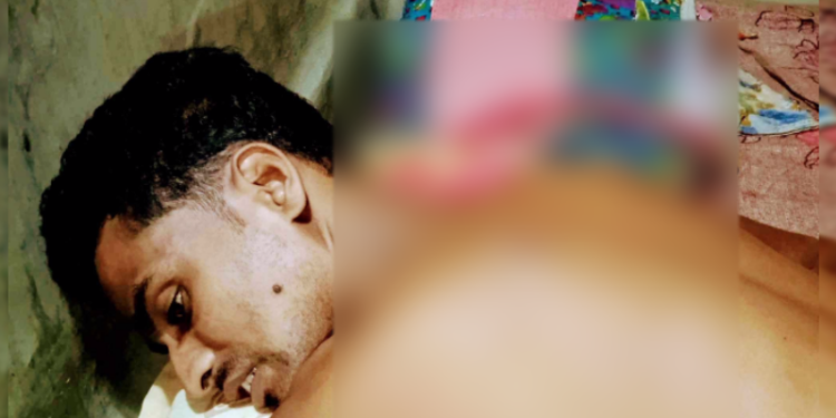 বগুড়ার বাকপ্রতিবন্ধীকে হত্যার চেষ্টায় ছুরিকাঘাত