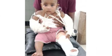 সোনারগাঁয়ে শিশু সন্তানের হাত পা ভাঙার অভিযোগ মায়ের বিরুদ্ধে