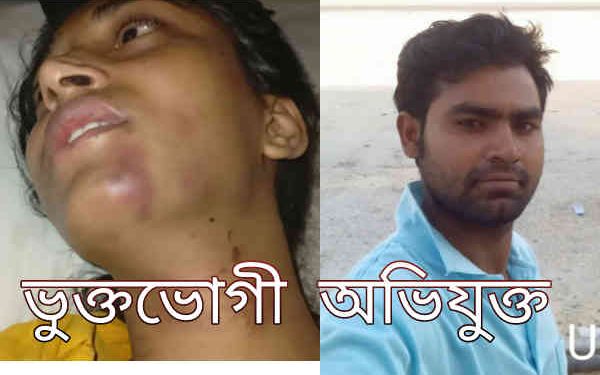 সোনারগাঁয়ে যৌতুকের টাকা না পেয়ে স্ত্রীকে হত্যা চেষ্টা, স্বামী গ্রেপ্তার