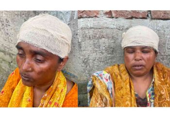 সোনারগাঁয়ে কিশোরীসহ ৩ নারীকে কুপিয়ে জখম, থানায় অভিযোগ